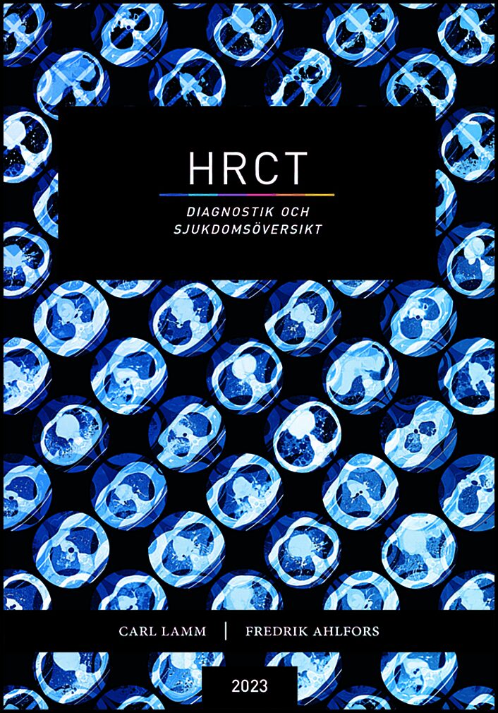 Lamm, Carl | Ahlfors, Fredrik | HRCT : Diagnostik och sjukdomsöversikt