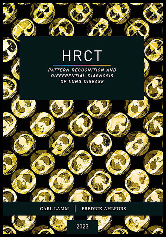 Lamm, Carl | Ahlfors, Fredrik | HRCT : Pattern recognition and differential diagnosis of lung disease