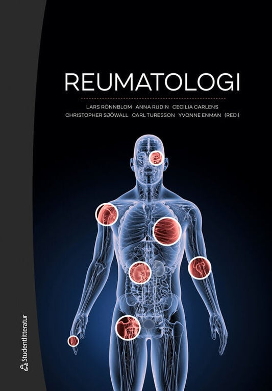 Rönnblom, Lars | Rudin, Anna | et al | Reumatologi