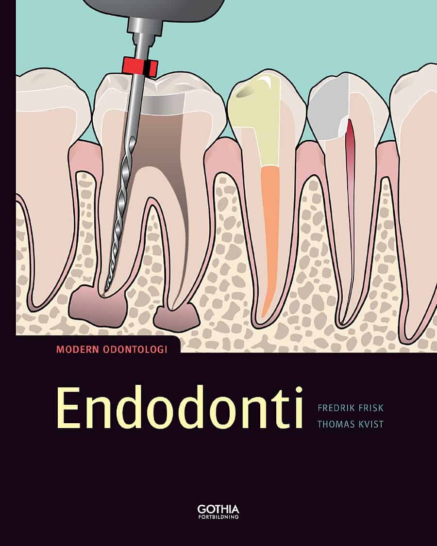 Frisk, Fredrik| Kvist, Thomas | Endodonti